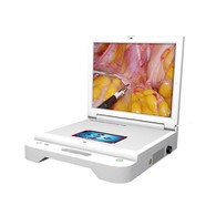 Kamera Endoskopi THT Tampilan HD Portabel